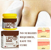 Lipoma Cream for removing lipomas and subcutaneous, suitable for all skin types